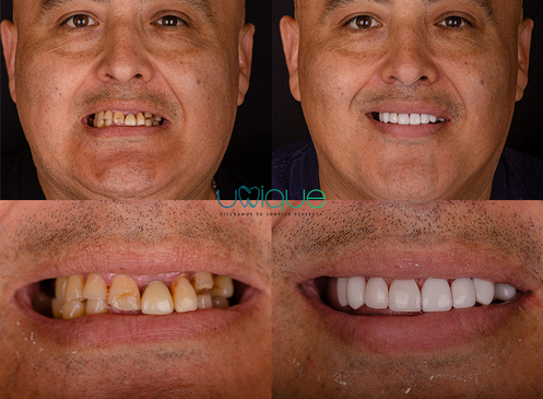 Slider image (4) Unique Dental Clinic